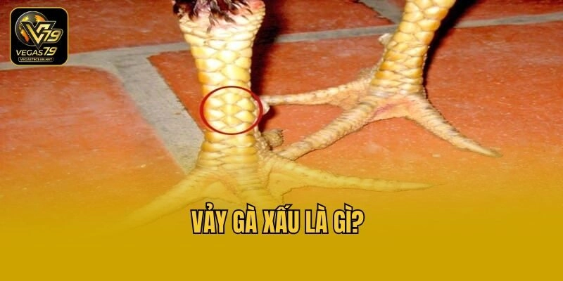 Vảy gà xấu là gì?